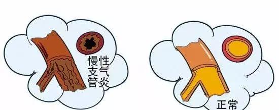 苏州看支气管的医院哪里好(图1)